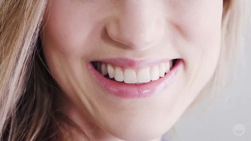 video-clearcorrect-poster